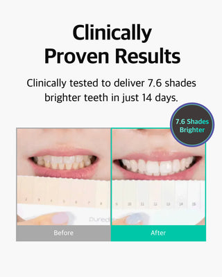 Live Orals PureDia Teeth Whitening Set